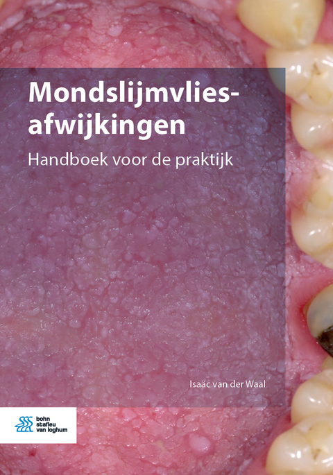 Mondslijmvliesafwijkingen - Isa&auml;c van der Waal