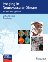Imaging in Neurovascular Disease -  Waleed Brinjikji,  Timo Krings