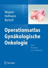 Operationsatlas Gyn&auml;kologische Onkologie - 