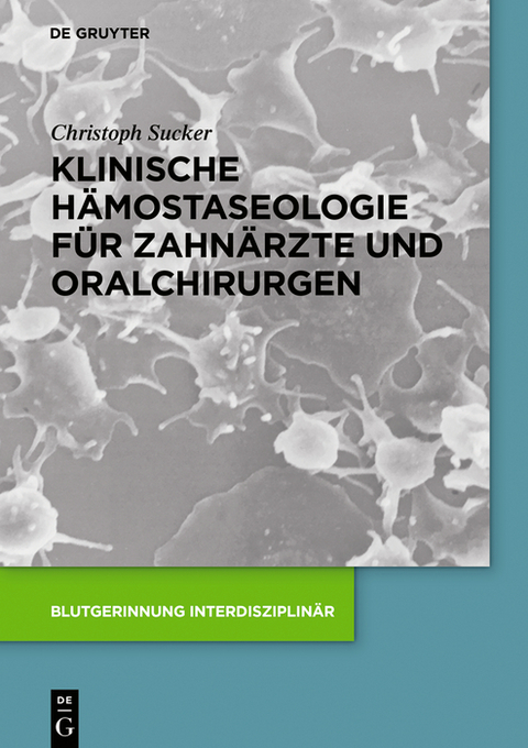 Klinische H&auml;mostaseologie f&uuml;r Zahn&auml;rzte und Oralchirurgen - Christoph Sucker