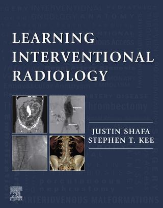 Learning Interventional Radiology eBook