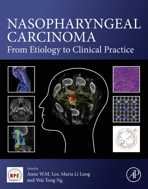 Nasopharyngeal Carcinoma - 