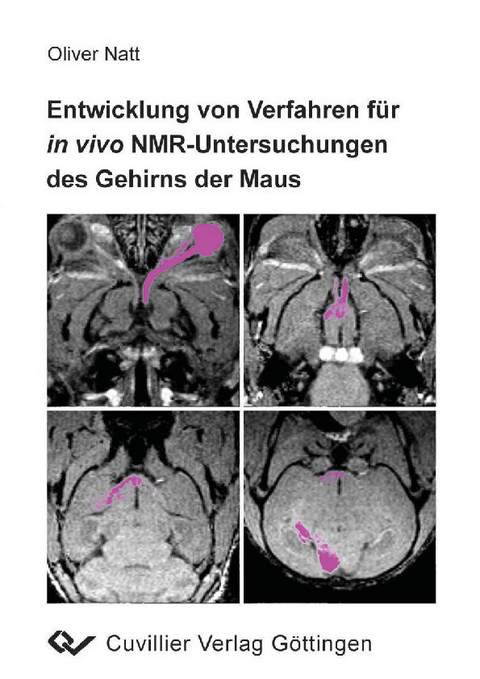 Entwicklung von Verfahren für in vivo NMR-Untersuchungen des Gehirns der Maus -  Oliver Natt