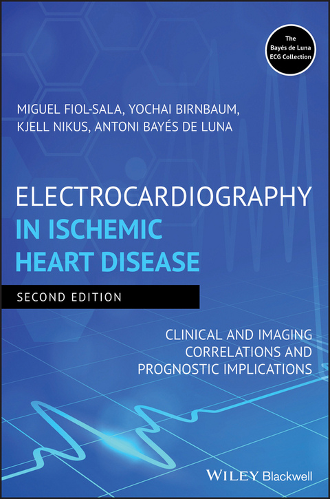 Electrocardiography in Ischemic Heart Disease - Miquel Fiol-Sala, Yochai Birnbaum, Kjell Nikus, Antoni Bay&eacute;s de Luna