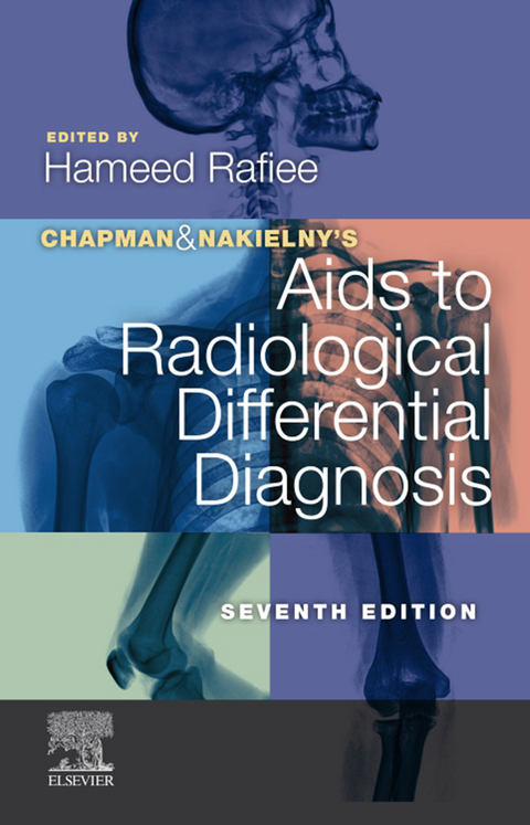Chapman & Nakielny's Aids to Radiological Differential Diagnosis - 