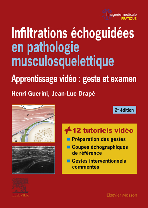 Infiltrations echoguidees en pathologie musculosquelettique -  Jean-Luc Drape,  Henri Guerini,  Paul Legmann