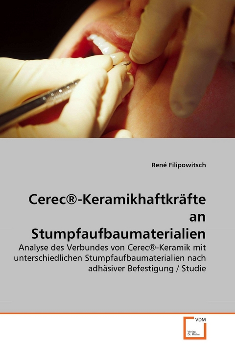 Cerec&reg;-Keramikhaftkr&auml;fte an Stumpfaufbaumaterialien -  Ren&eacute; Filipowitsch