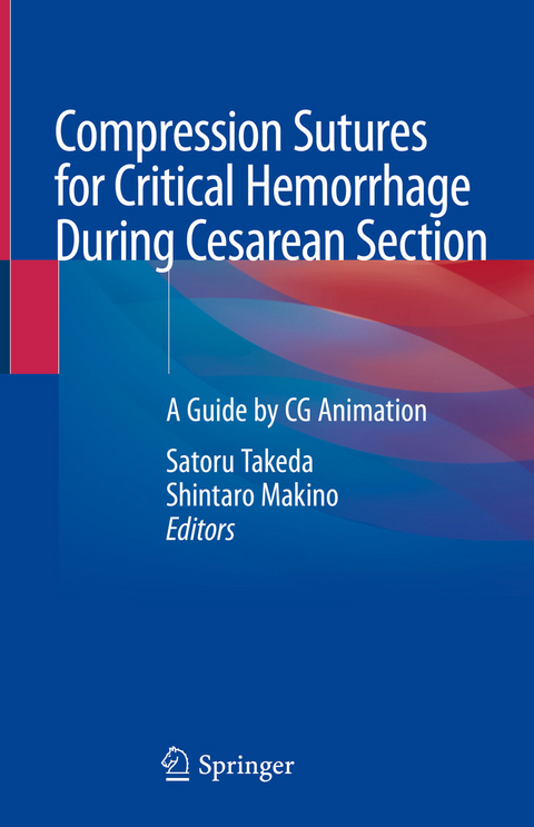 Compression Sutures for Critical Hemorrhage During Cesarean Section - 