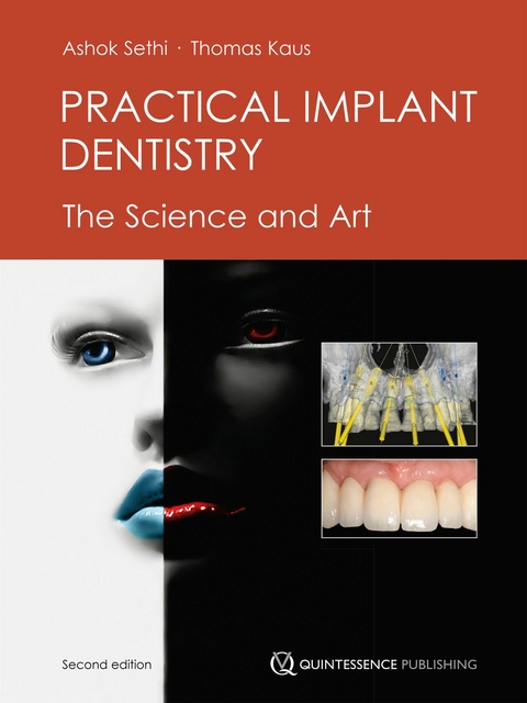 Practical Implant Dentistry - Ashok Sethi, Thomas Kaus