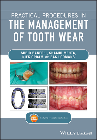Practical Procedures in the Management of Tooth Wear