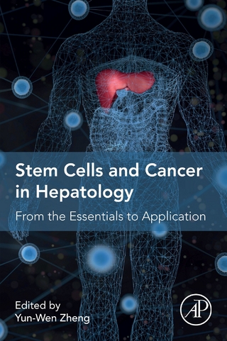 Stem Cells and Cancer in Hepatology