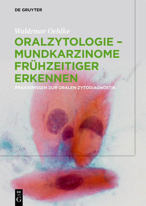 Oralzytologie - Mundkarzinome fr&uuml;hzeitiger erkennen -  Waldemar Oehlke