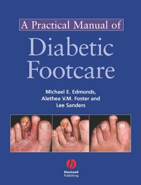 A Practical Manual of Diabetic Foot Care - Michael E. Edmonds, Alethea V. M. Foster, Lee Sanders