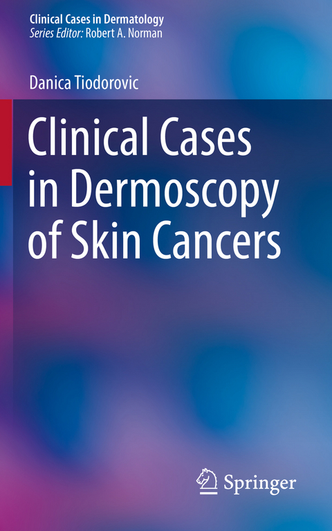Clinical Cases in Dermoscopy of Skin Cancers - Danica Tiodorovic