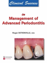 Clinical Success in Management of Advanced Periodontitis - Roger Detienville