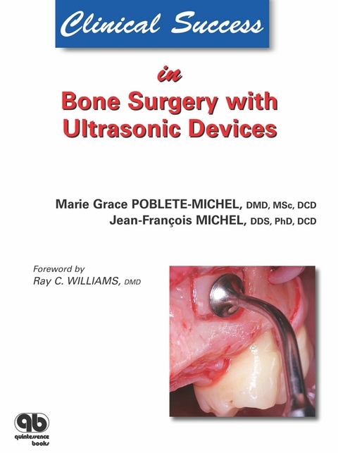 Clinical Success in Bone Surgery with Ultrasonic Devices - Marie G. Poblete-Michel, Jean-Franҫois Michel