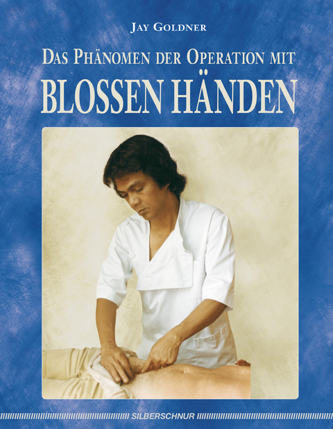 Das Ph&auml;nomen der Operation mit blossen H&auml;nden - Jay Goldner