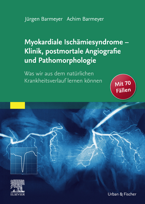 Die myokardialen Isch&auml;miesyndrome - Klinik und postmortale Pathomorphologie -  J&uuml;rgen Barmeyer,  Achim Barmeyer