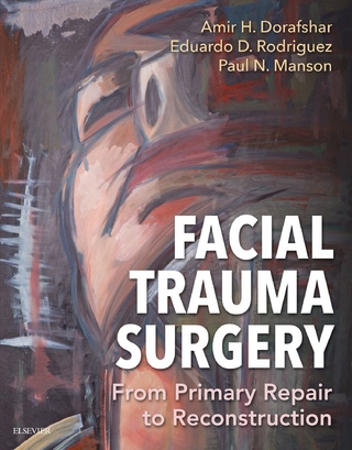 Facial Trauma Surgery E-Book