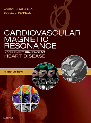 Cardiovascular Magnetic Resonance