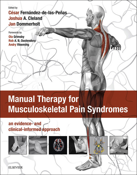 Manual Therapy for Musculoskeletal Pain Syndromes - 