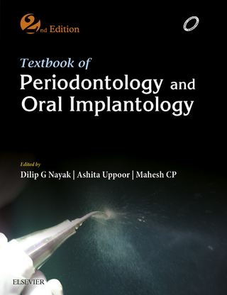 Textbook of Periodontology and Oral Implantology - E-Book