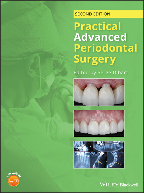 Practical Advanced Periodontal Surgery - 