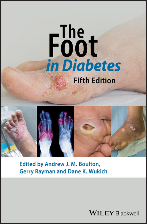 The Foot in Diabetes - 