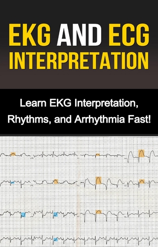 EKG and ECG Interpretation