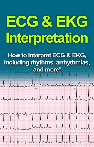 ECG & EKG Interpretation