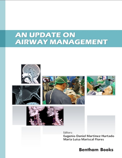 Update on Airway Management - 