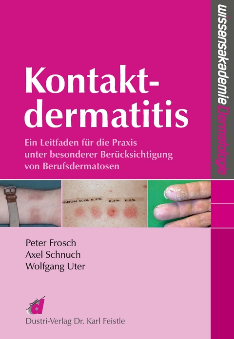 Kontaktdermatitis -  Peter Frosch,   Axel Schnuch,  et al