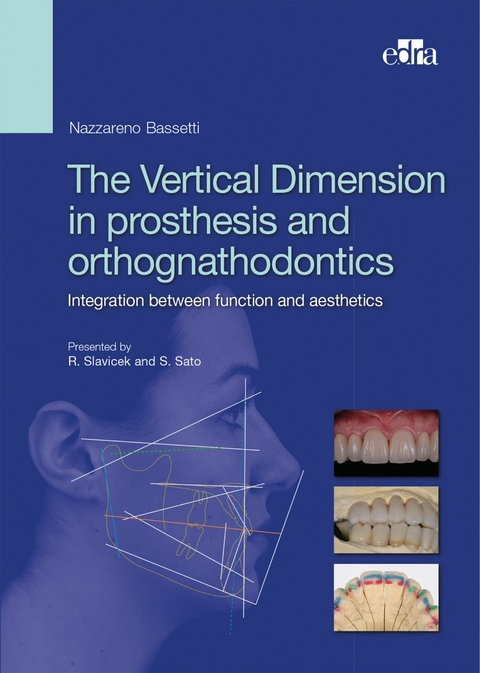 Vertical Dimension in Prosthetis and Orthognathodontics. -  Nazzareno Bassetti