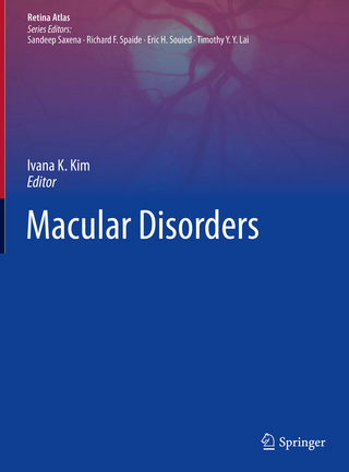 Macular Disorders