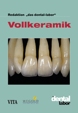 Vollkeramik - 
