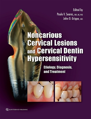 Noncarious Cervical Lesions and Cervical Dentin Hypersensitivity