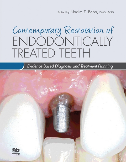 Contemporary Restoration of Endodontically Treated Teeth - Nadim Z. Baba