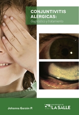 Conjuntivitis al&eacute;rgicas -  Sandra Johanna Garzon Parra