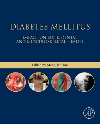Diabetes Mellitus