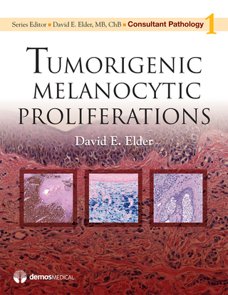 Tumorigenic Melanocytic Proliferations