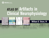 Atlas of Artifacts in Clinical Neurophysiology - William O. Tatum