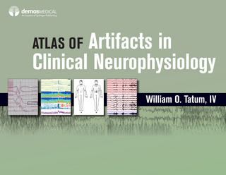 Atlas of Artifacts in Clinical Neurophysiology