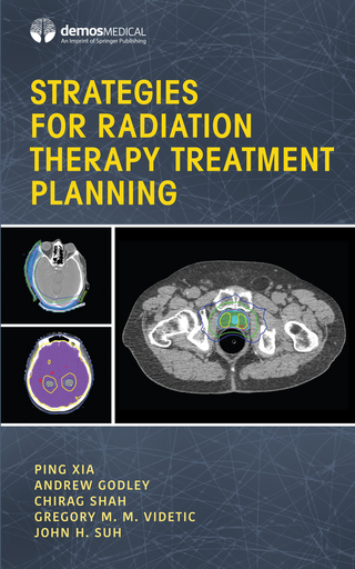 Strategies for Radiation Therapy Treatment Planning