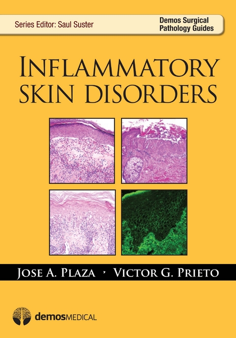 Inflammatory Skin Disorders - Jose Plaza, Victor Gerardo Prieto