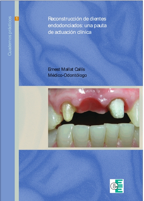 Reconstrucci&oacute;n de dientes endodonciados - Ernest Mallat Call&iacute;s