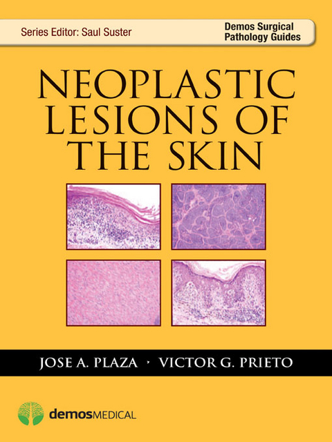 Neoplastic Lesions of the Skin - Jose Plaza, Victor Gerardo Prieto