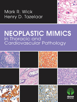 Neoplastic Mimics in Thoracic and Cardiovascular Pathology - Henry D. Tazelaar, Mark R. Wick