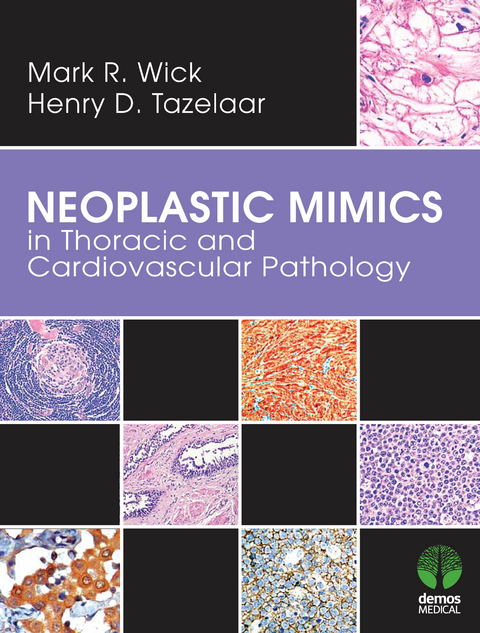 Neoplastic Mimics in Thoracic and Cardiovascular Pathology - Henry D. Tazelaar, Mark R. Wick