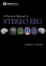 A Practical Approach to Stereo EEG - 