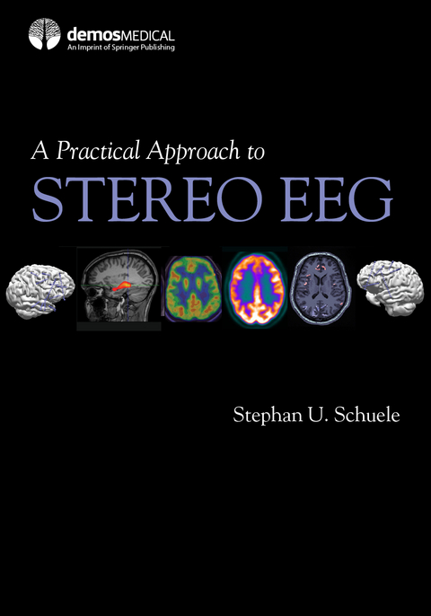 A Practical Approach to Stereo EEG - 